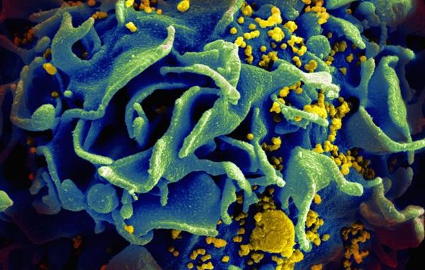 HIV micro